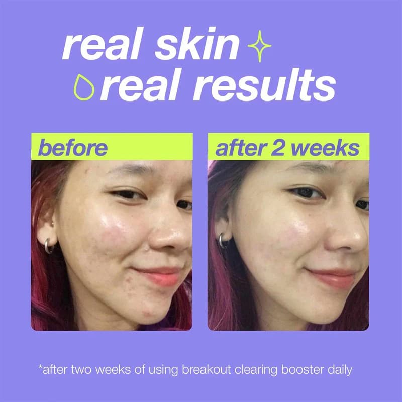 Dermalogica Clear Start Breakout Clearing Booster 30ml